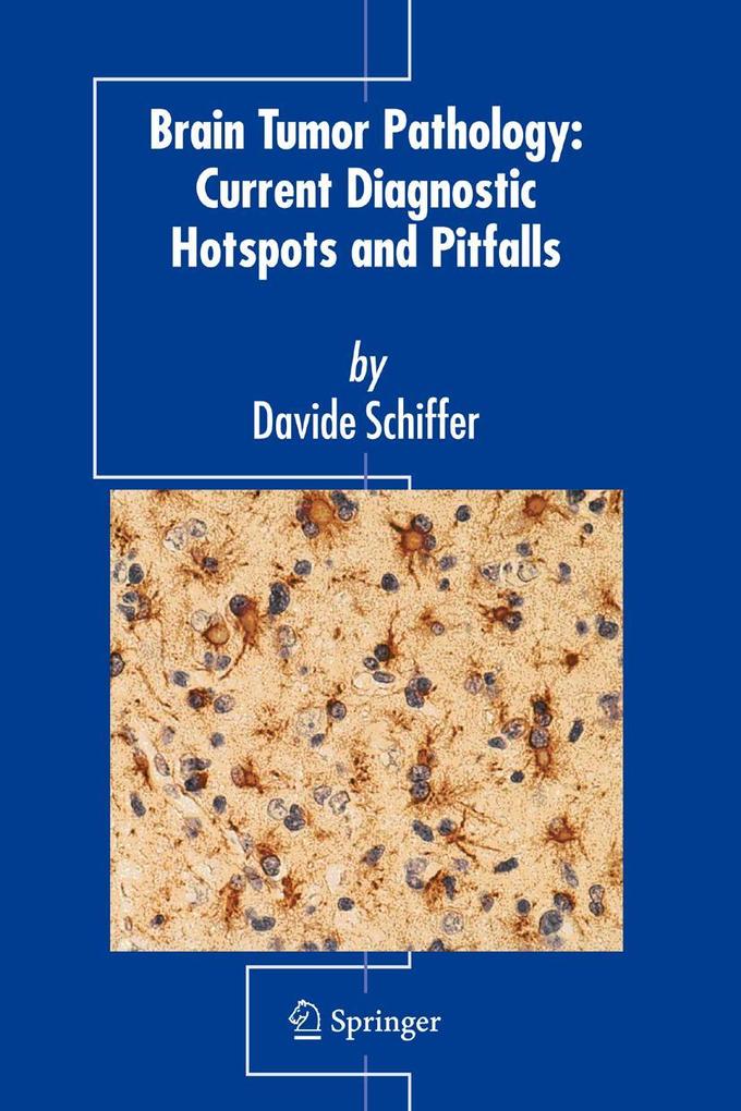 Brain Tumor Pathology: Current Diagnostic Hotspots and Pitfalls - Davide Schiffer