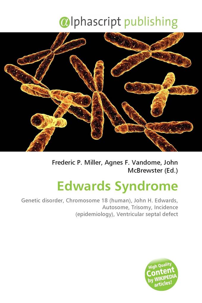 Edwards Syndrome