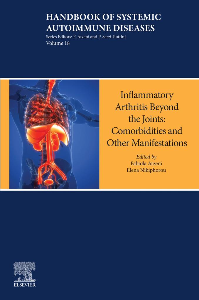 Inflammatory Arthritis Beyond the Joints