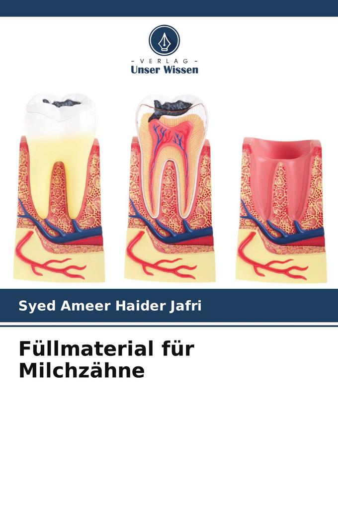 Füllmaterial für Milchzähne
