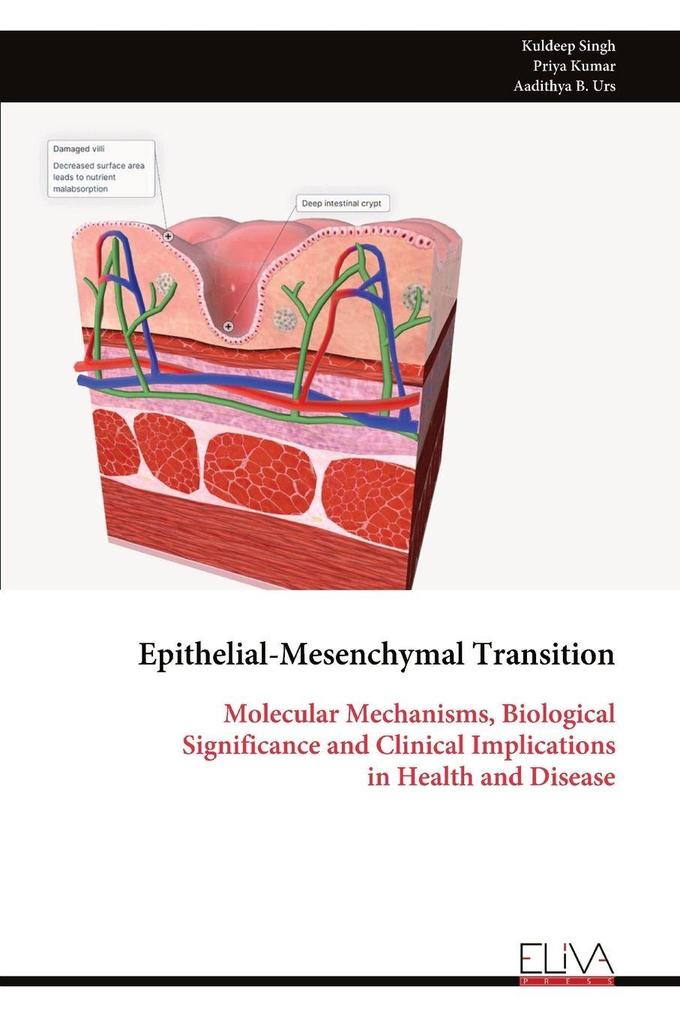 Epithelial-Mesenchymal Transition