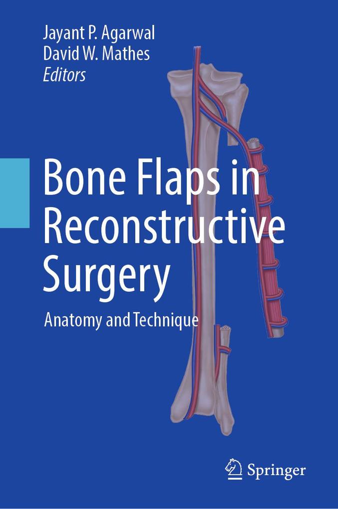 Bone Flaps in Reconstructive Surgery