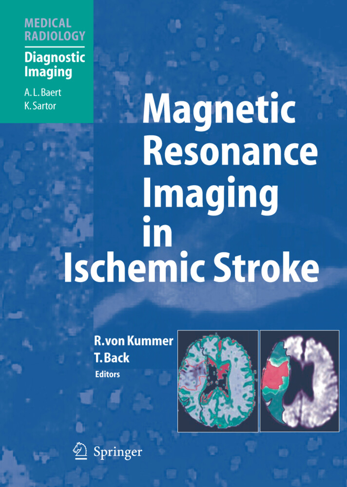 Magnetic Resonance Imaging in Ischemic Stroke - K. Sartor