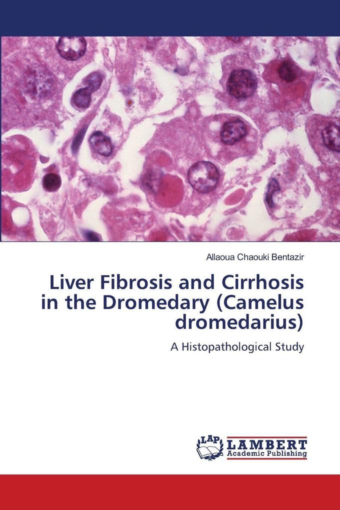 Liver Fibrosis and Cirrhosis in the Dromedary (Camelus dromedarius)
