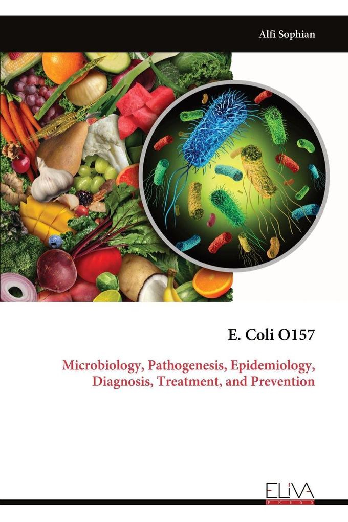 E. Coli O157