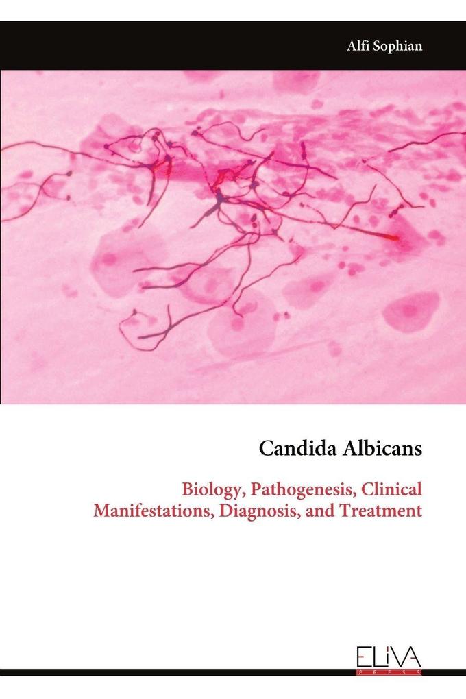 Candida Albicans