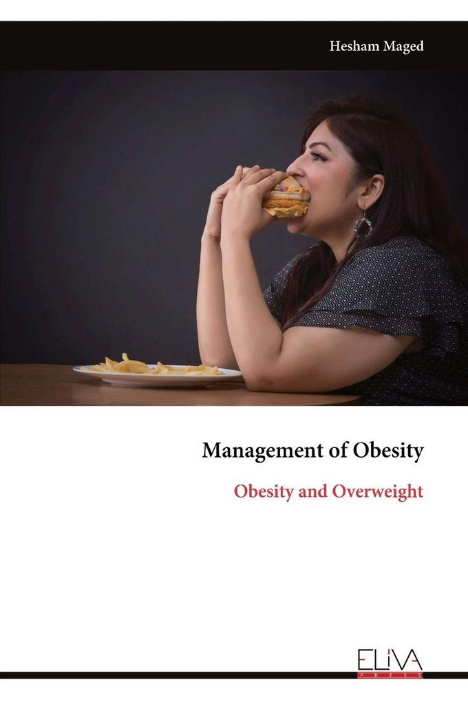 Management of Obesity