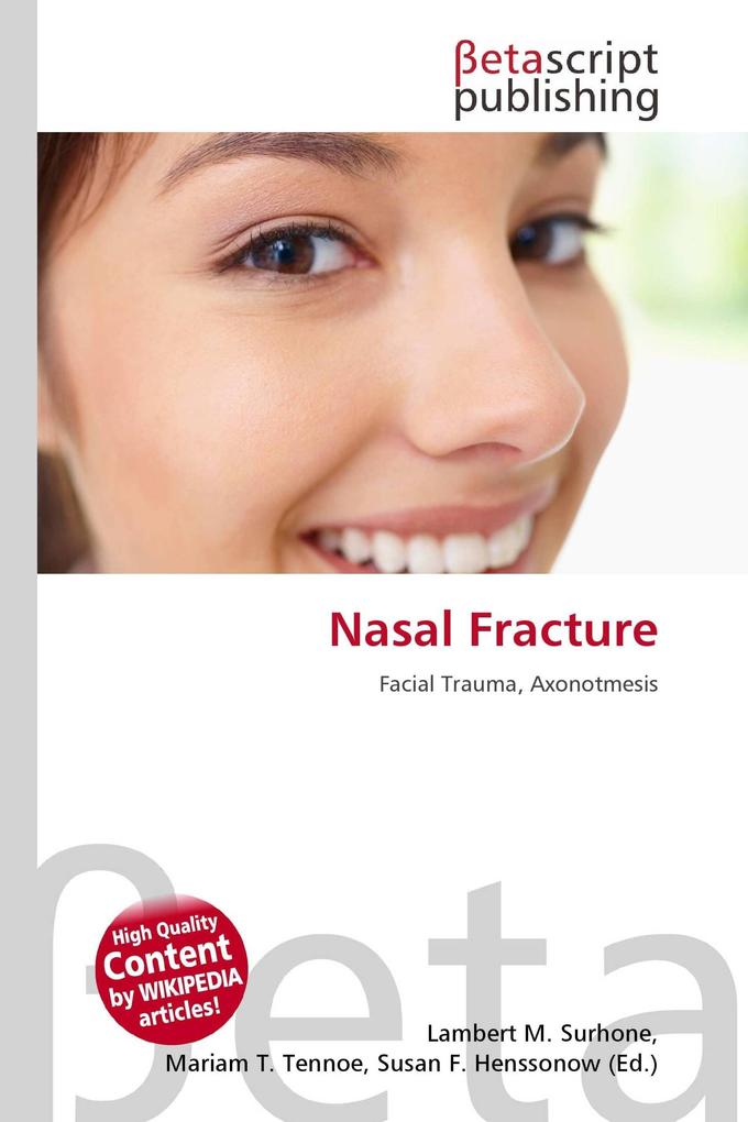 Nasal Fracture