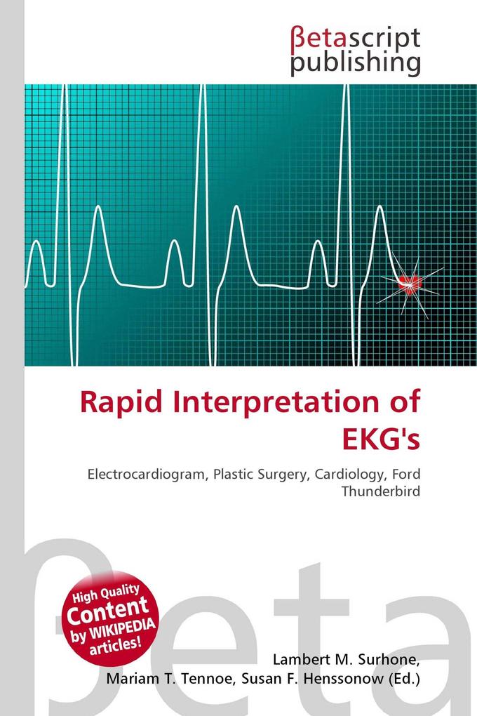 Rapid Interpretation of EKG's
