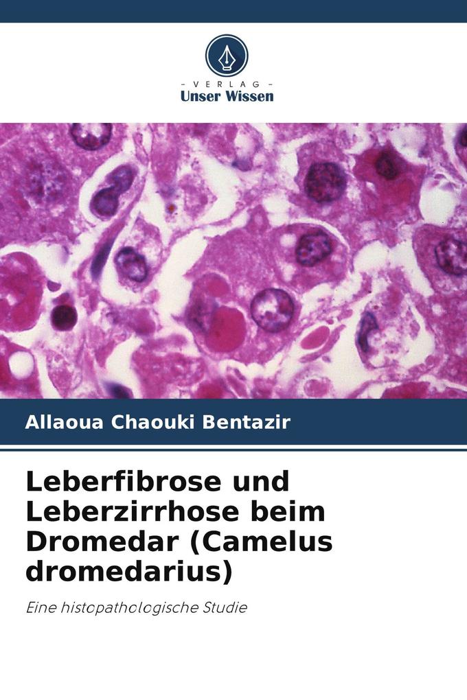 Leberfibrose und Leberzirrhose beim Dromedar (Camelus dromedarius)