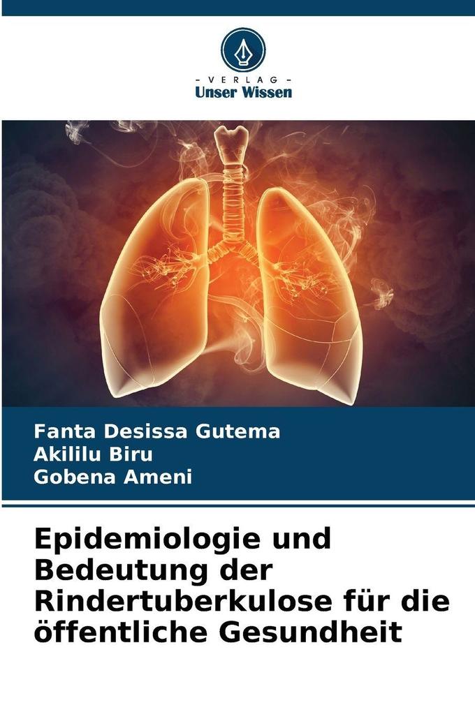 Epidemiologie und Bedeutung der Rindertuberkulose für die öffentliche Gesundheit