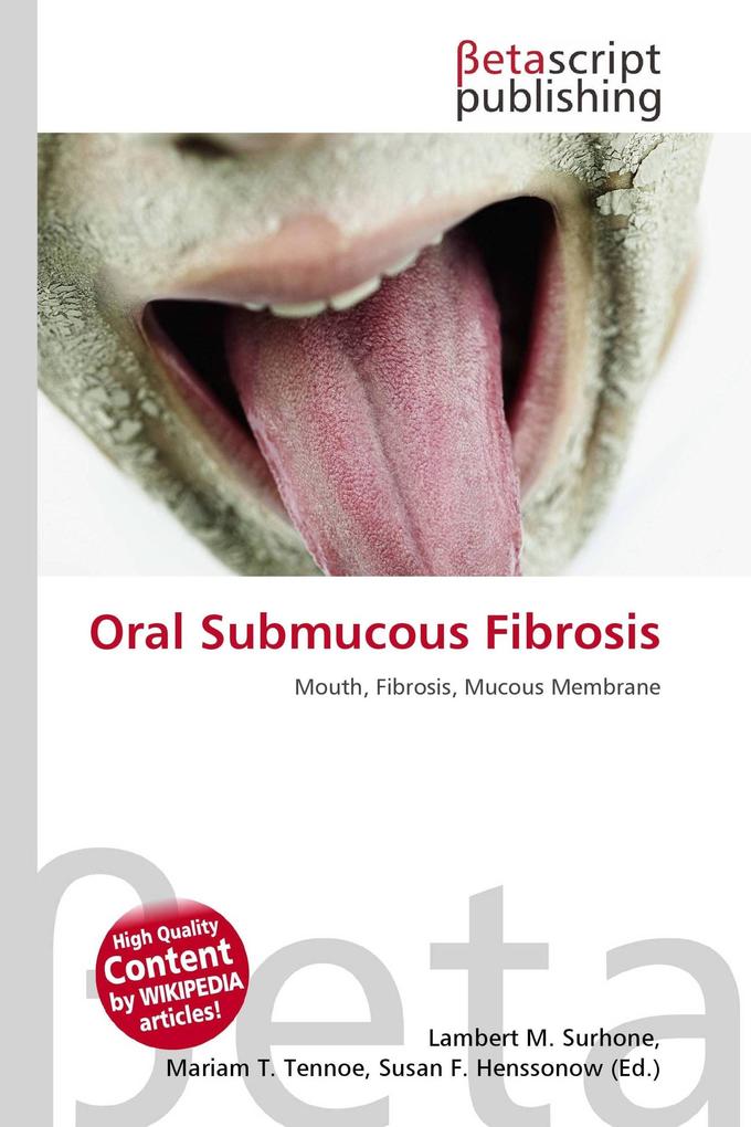 Oral Submucous Fibrosis