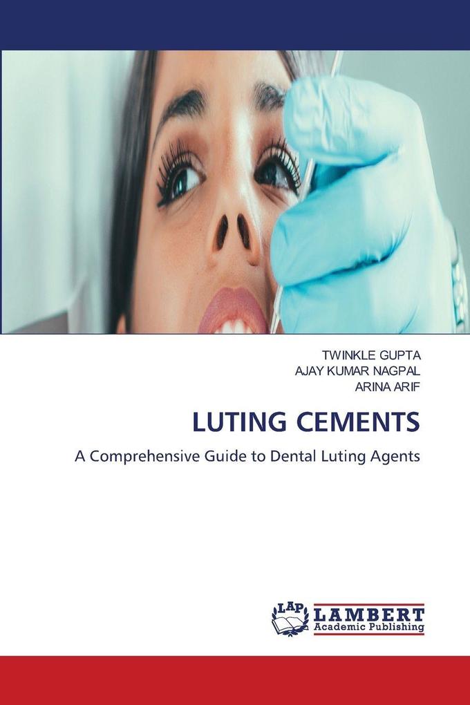 LUTING CEMENTS