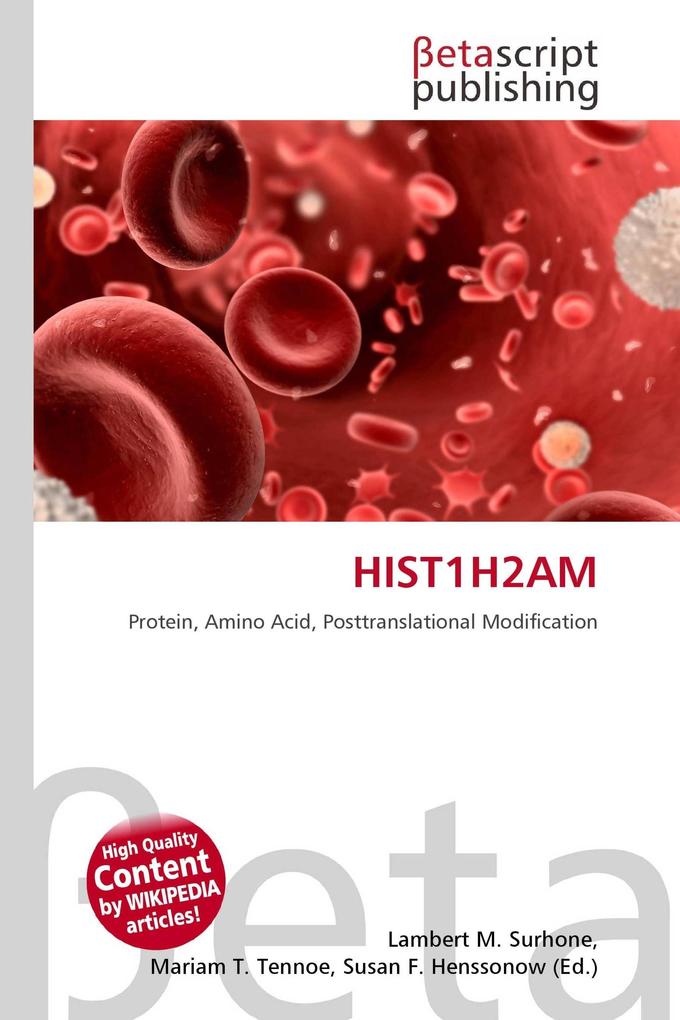 HIST1H2AM