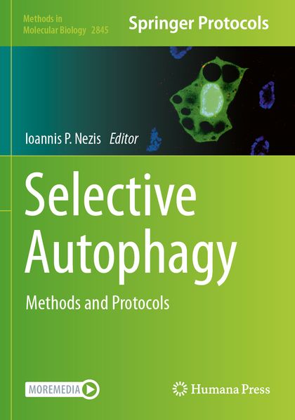 Selective Autophagy
