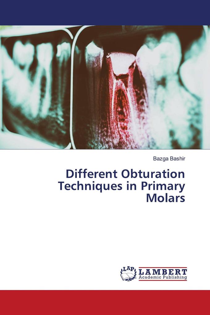 Different Obturation Techniques in Primary Molars