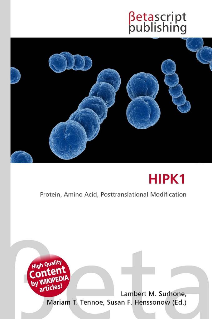 HIPK1