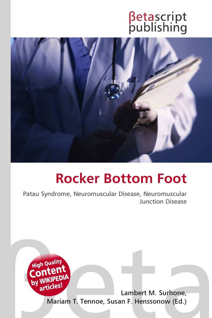 Rocker Bottom Foot