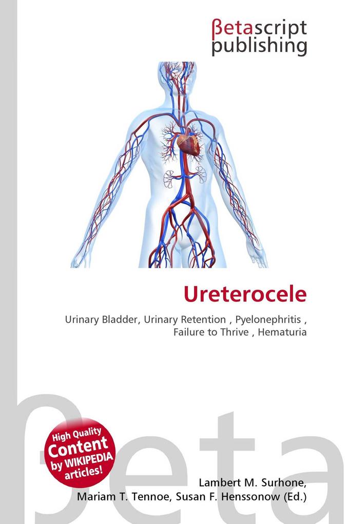 Ureterocele