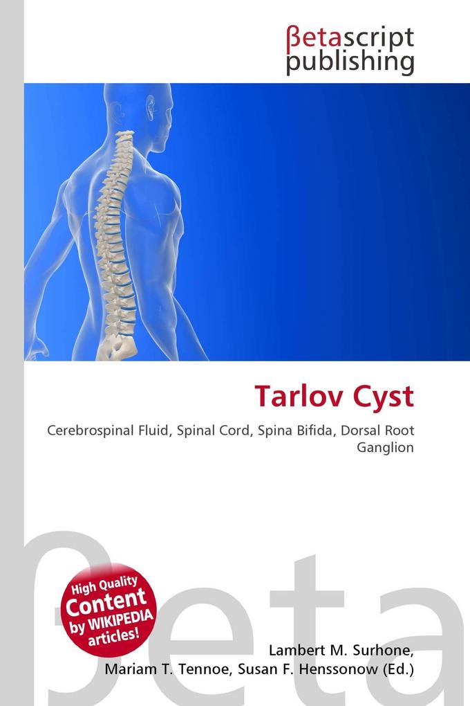 Tarlov Cyst