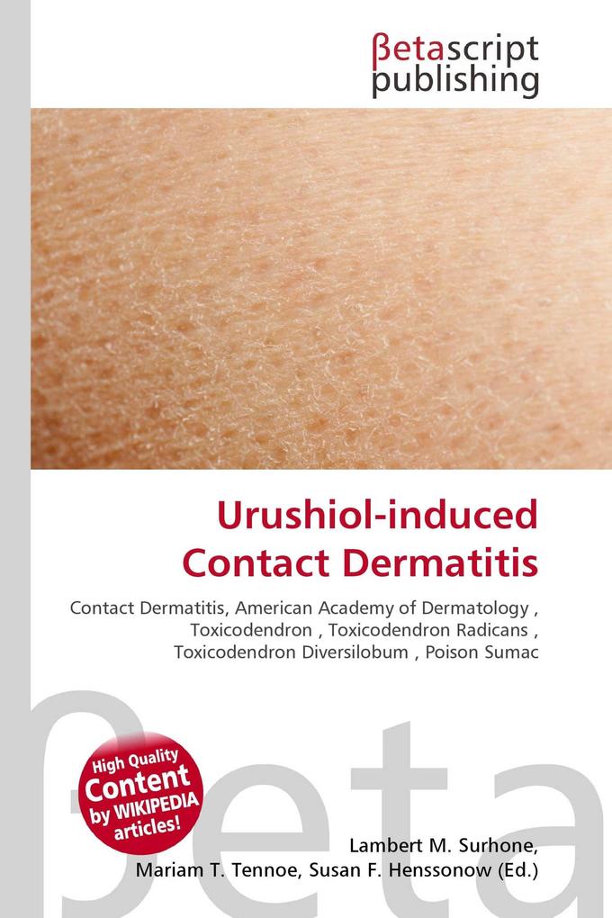 Urushiol-induced Contact Dermatitis