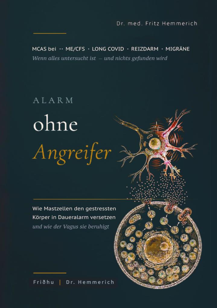 Alarm ohne Angreifer: MCAS bei ME/CFS Long Covid Reizdarm und Migräne