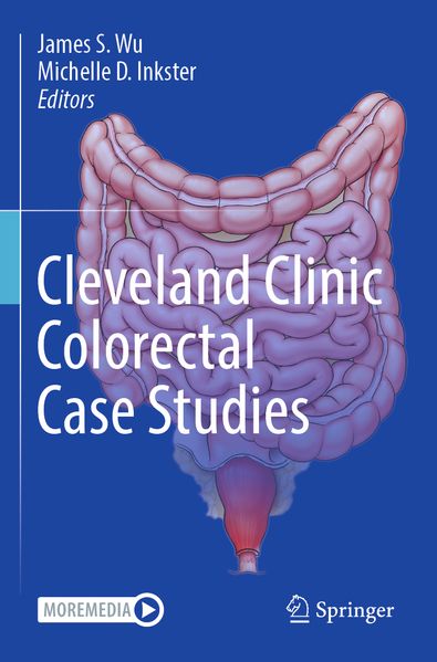 Cleveland Clinic Colorectal Case Studies