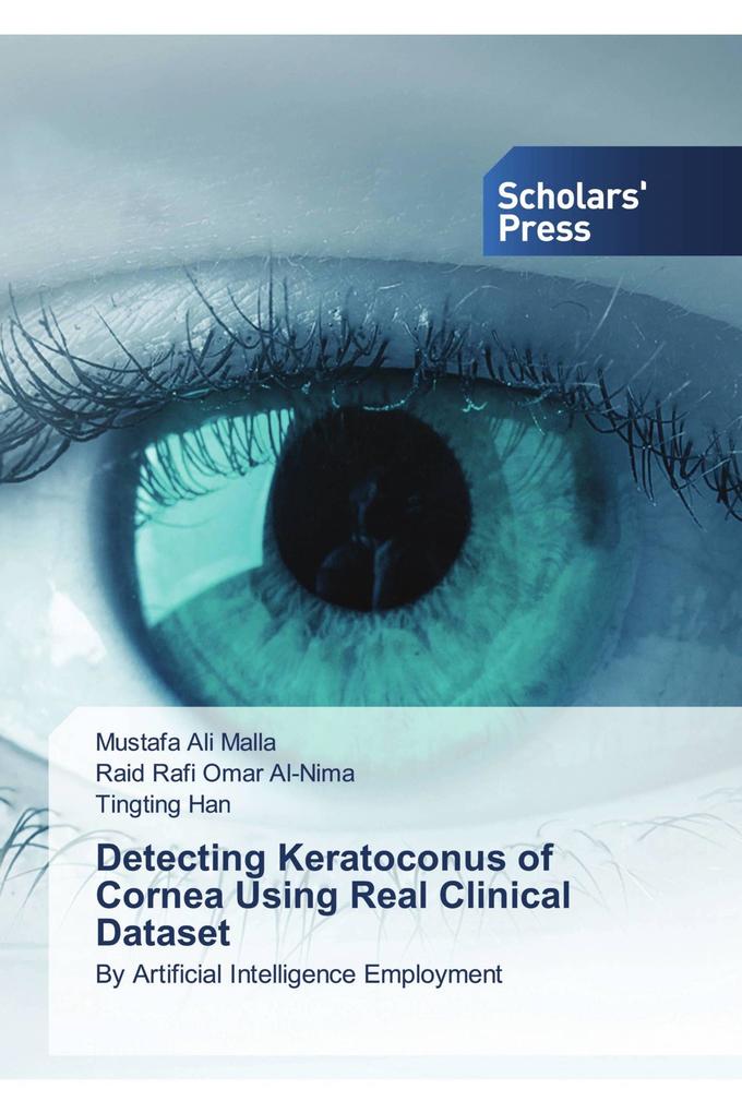 Detecting Keratoconus of Cornea Using Real Clinical Dataset