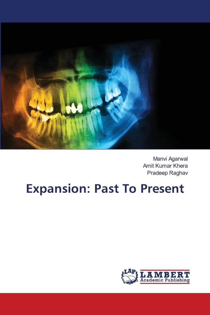 Expansion: Past To Present