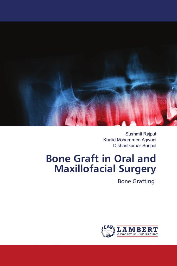 Bone Graft in Oral and Maxillofacial Surgery