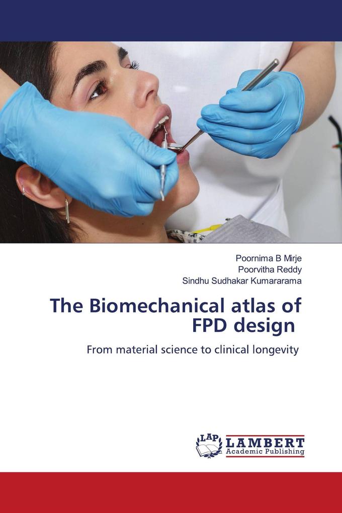 The Biomechanical atlas of FPD design