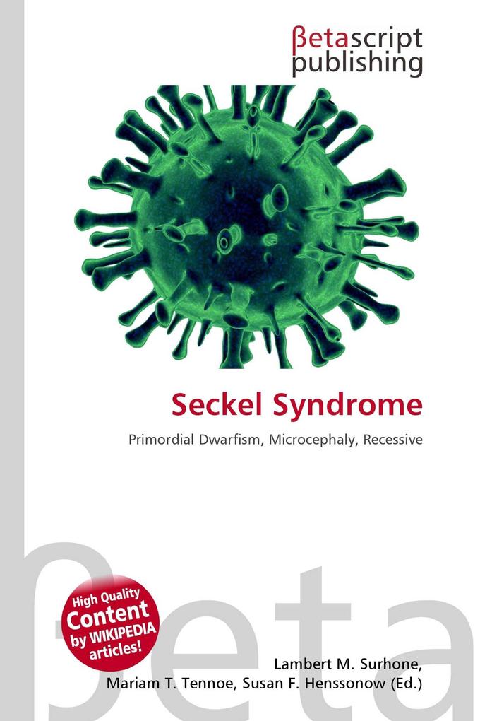 Seckel Syndrome