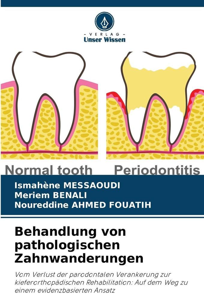 Behandlung von pathologischen Zahnwanderungen