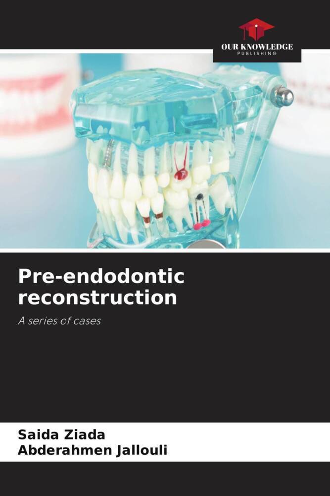 Pre-endodontic reconstruction
