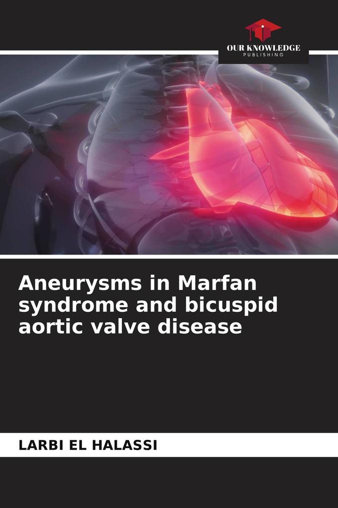 Aneurysms in Marfan syndrome and bicuspid aortic valve disease