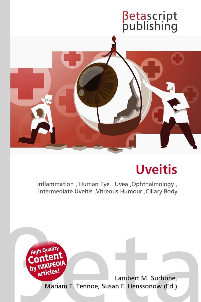 Uveitis