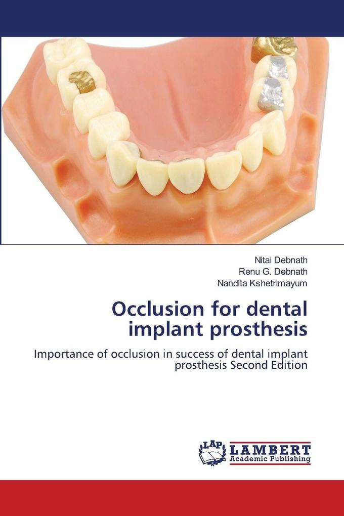 Occlusion for dental implant prosthesis