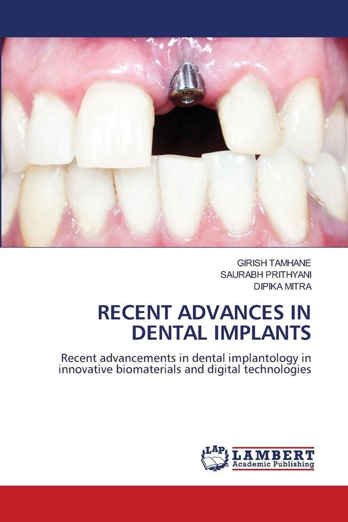 RECENT ADVANCES IN DENTAL IMPLANTS