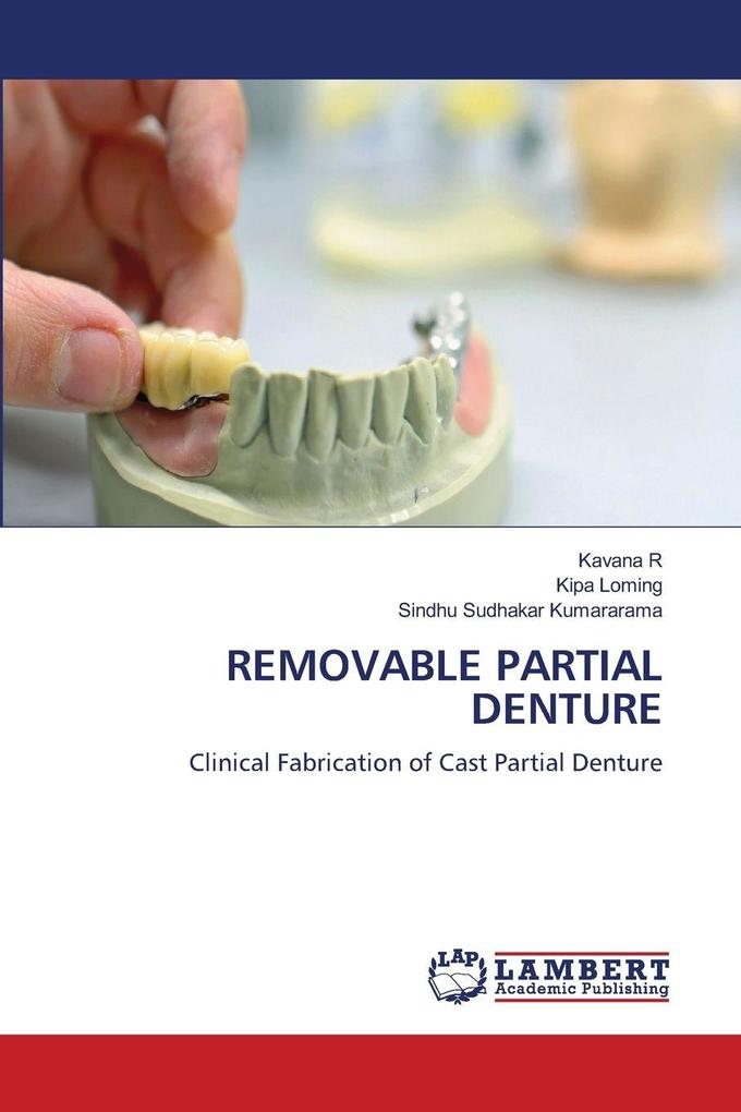 REMOVABLE PARTIAL DENTURE