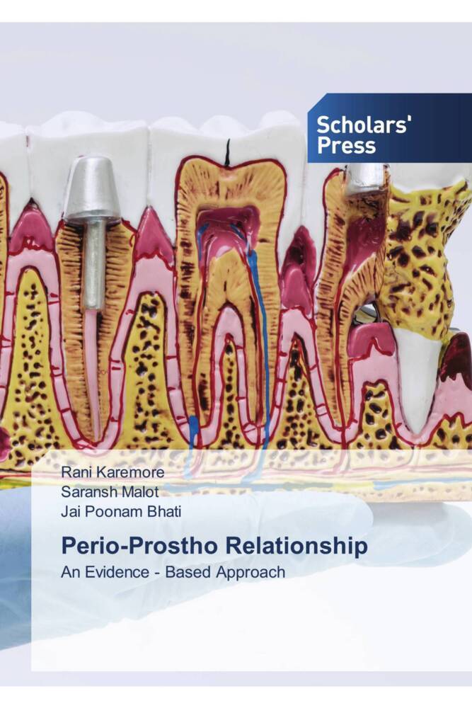Perio-Prostho Relationship