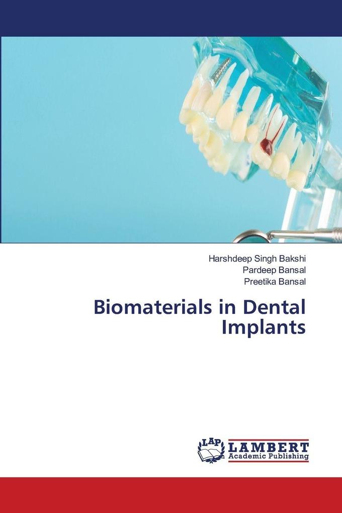 Biomaterials in Dental Implants