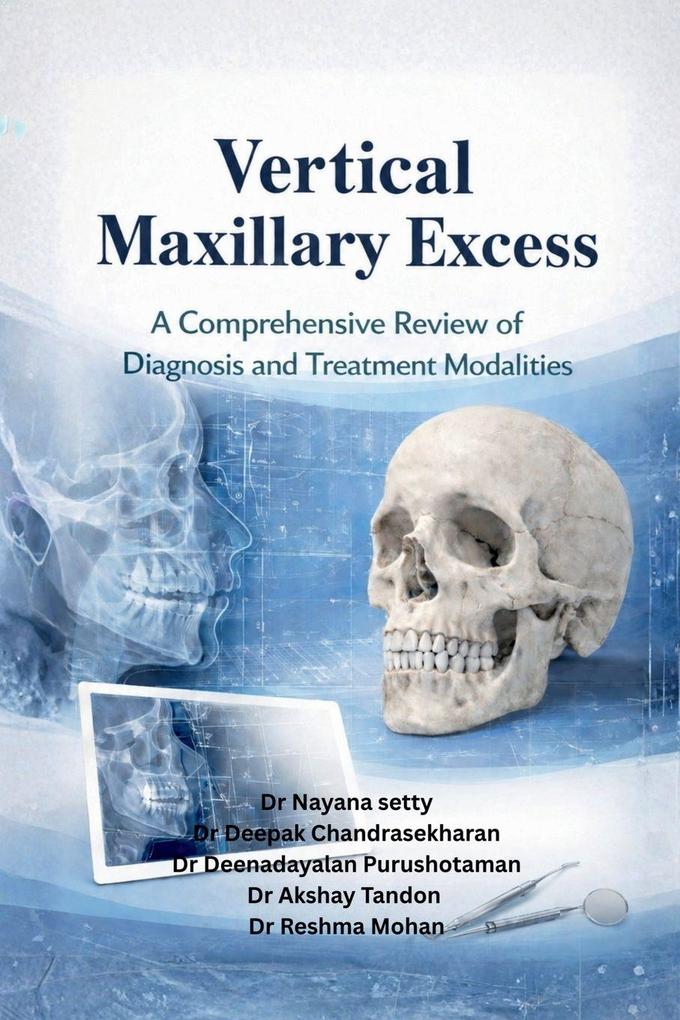 Vertical maxillary excess