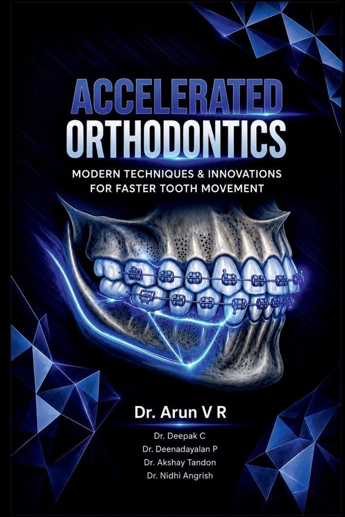 ACCELERATED ORTHODONTICS