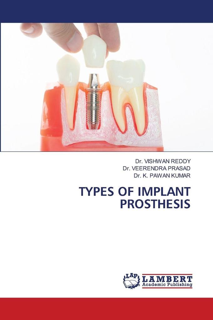 TYPES OF IMPLANT PROSTHESIS