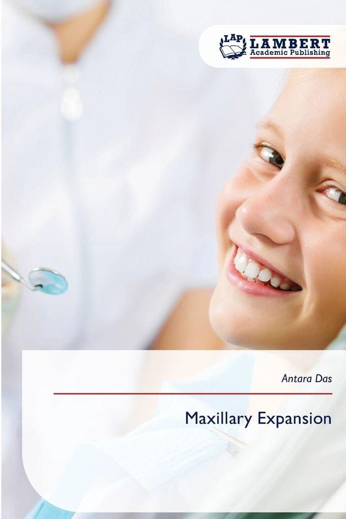 Maxillary Expansion
