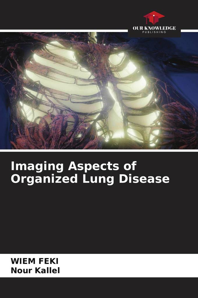 Imaging Aspects of Organized Lung Disease
