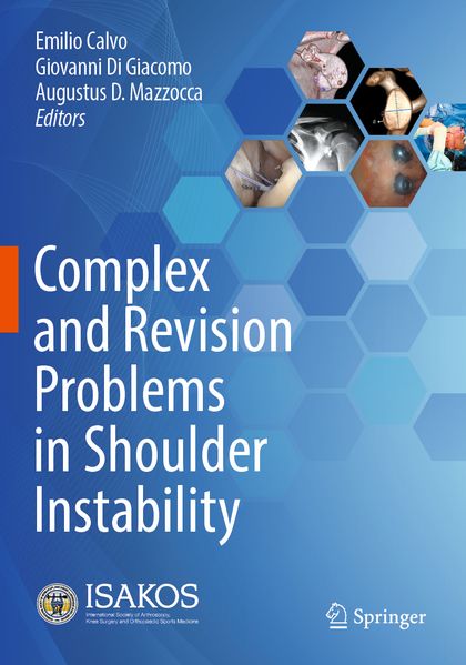 Complex and Revision Problems in Shoulder Instability