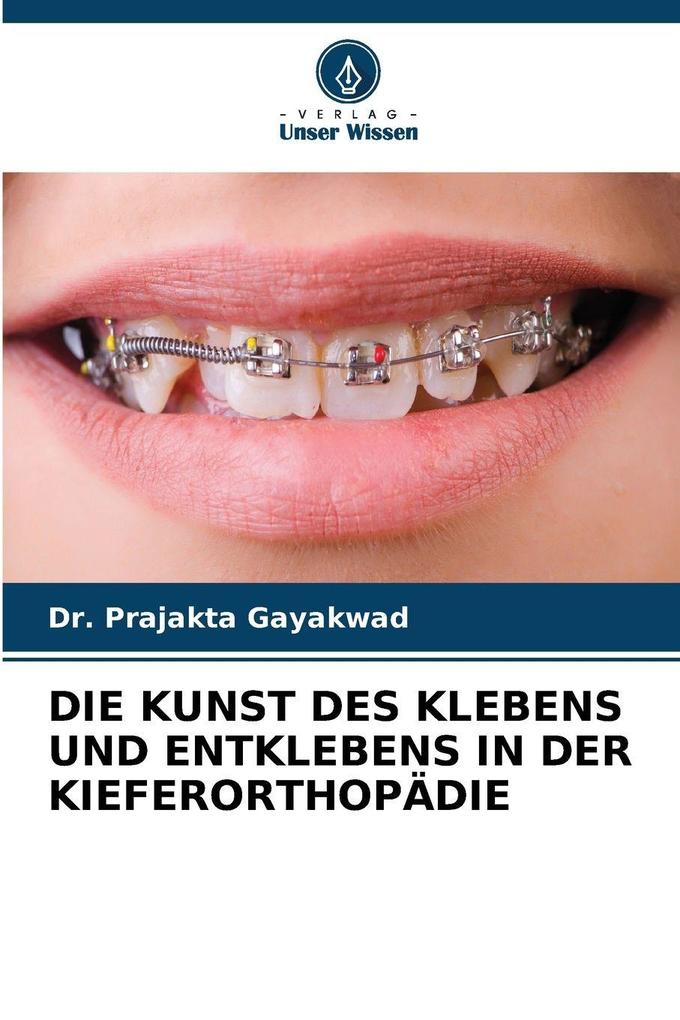 DIE KUNST DES KLEBENS UND ENTKLEBENS IN DER KIEFERORTHOPÄDIE