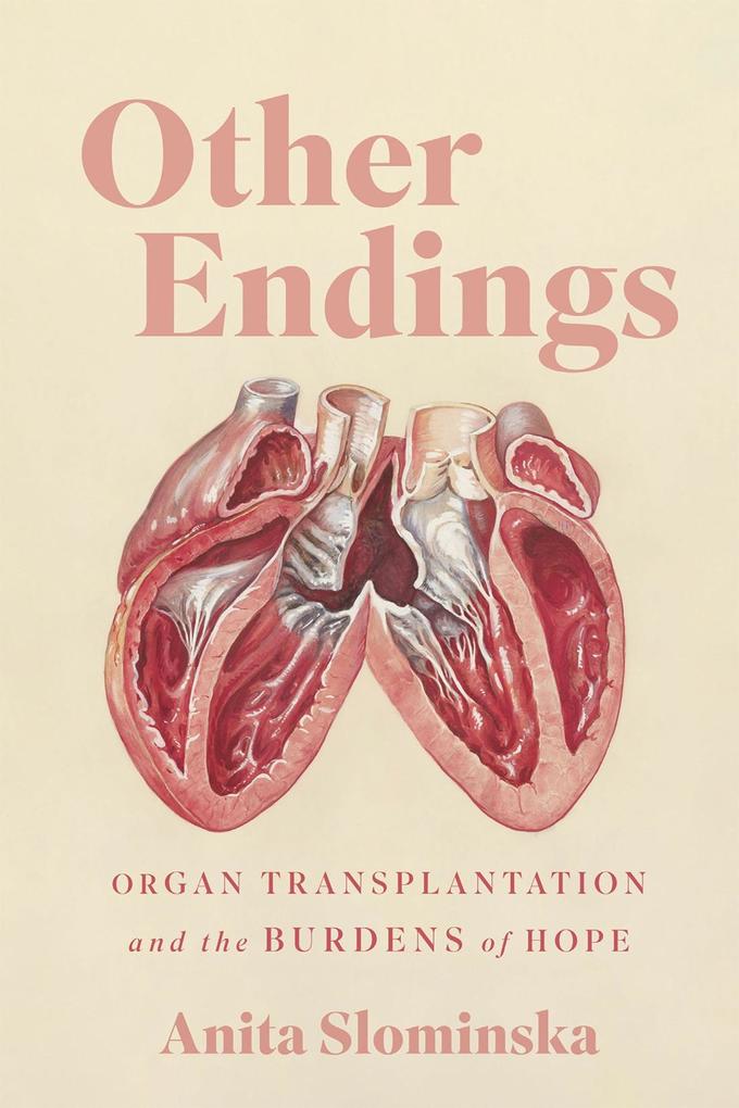Other Endings