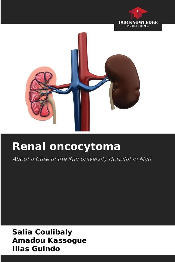 Renal oncocytoma